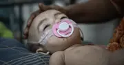 ২৪ ঘণ্টায় আরও ৩ শিশুর মৃত্যু, হামে মৃতের সংখ্যা ৭৫৩