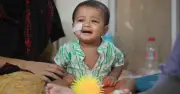 ২৪ ঘণ্টায় হাম সন্দেহে আরও ২ জনের মৃত্যু, মোট ৭৪৭