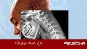 প্রযুক্তির কারণে ‘ফোন বডি’র শিকার: দুর্বল হাত, ঝাপসা দৃষ্টি